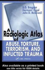 50093 - B. G. Brogdon,  John D. McDowell,, B.G.B-J.D.McD. - Radiologic Atlas of Abuse, Torture, Terrorism, and Inflicted